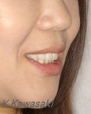 ���×�@�������ȁE�R�����ȁE�C���v�����g�̐�莕�ȁE�������Ȉ�@�i���{�s�j