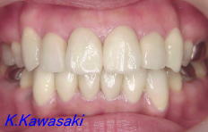 ���×�@�������ȁE�R�����ȁE�C���v�����g�̐�莕�ȁE�������Ȉ�@�i���{�s�j