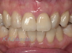 ���×�@�������ȁE�R�����ȁE�C���v�����g�̐�莕�ȁE�������Ȉ�@�i���{�s�j