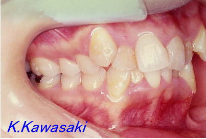 �p���i�K�^�K�^�j�̎��×�@�����E�R�����ȁE�C���v�����g�̐�莕�ȁE�������Ȉ�@�i���{�s�j