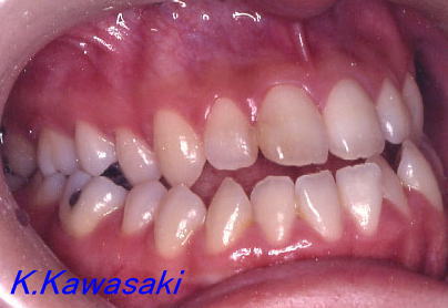 ���i���󂯌��̎��×�@�����E�R�����ȁE�C���v�����g�̐�莕�ȁE�������Ȉ�@�i���{�s�j