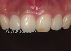 ���×�@�������ȁE�R�����ȁE�C���v�����g�̐�莕�ȁE�������Ȉ�@�i���{�s�j