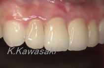 ���×�@�������ȁE�R�����ȁE�C���v�����g�̐�莕�ȁE�������Ȉ�@�i���{�s�j