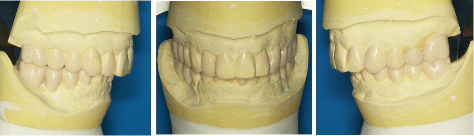 ���×�@�������ȁE�R�����ȁE�C���v�����g�̐�莕�ȁE�������Ȉ�@�i���{�s�j