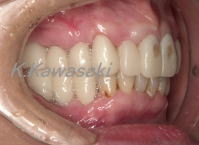 ���×�@�������ȁE�R�����ȁE�C���v�����g�̐�莕�ȁE�������Ȉ�@�i���{�s�j