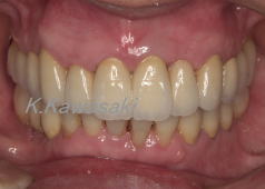 ���×�@�������ȁE�R�����ȁE�C���v�����g�̐�莕�ȁE�������Ȉ�@�i���{�s�j