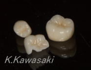 ���×�@�������ȁE�R�����ȁE�C���v�����g�̐�莕�ȁE�������Ȉ�@�i���{�s�j