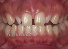 ���×�@�������ȁE�R�����ȁE�C���v�����g�̐�莕�ȁE�������Ȉ�@�i���{�s�j