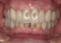 ���×�@�������ȁE�R�����ȁE�C���v�����g�̐�莕�ȁE�������Ȉ�@�i���{�s�j