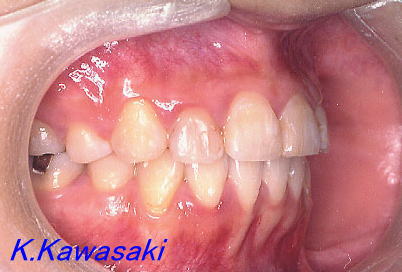 �p���i�K�^�K�^�j�̎��×�@�����E�R�����ȁE�C���v�����g�̐�莕�ȁE�������Ȉ�@�i���{�s�j