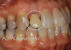 ���×�@�������ȁE�R�����ȁE�C���v�����g�̐�莕�ȁE�������Ȉ�@�i���{�s�j