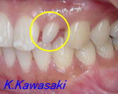 ���×�@�������ȁE�R�����ȁE�C���v�����g�̐�莕�ȁE�������Ȉ�@�i���{�s�j