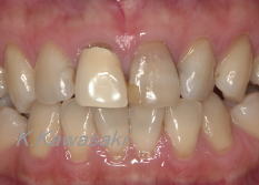 ���×�@�������ȁE�R�����ȁE�C���v�����g�̐�莕�ȁE�������Ȉ�@�i���{�s�j