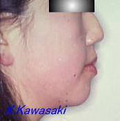 ���Ι����i�󂯌��j�̎��×�@�����E�R�����ȁE�C���v�����g�̐�莕�ȁE�������Ȉ�@�i���{�s�j