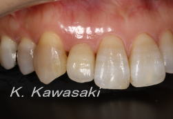 ���×�@�������ȁE�R�����ȁE�C���v�����g�̐�莕�ȁE�������Ȉ�@�i���{�s�j