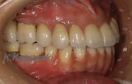 ���×�@�������ȁE�R�����ȁE�C���v�����g�̐�莕�ȁE�������Ȉ�@�i���{�s�j