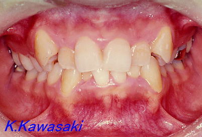 �p���i�K�^�K�^�j�̎��×�@�����E�R�����ȁE�C���v�����g�̐�莕�ȁE�������Ȉ�@�i���{�s�j