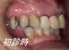 ���×�@�������ȁE�R�����ȁE�C���v�����g�̐�莕�ȁE�������Ȉ�@�i���{�s�j