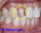 ���×�@�������ȁE�R�����ȁE�C���v�����g�̐�莕�ȁE�������Ȉ�@�i���{�s�j