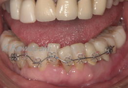 ���×�@�������ȁE�R�����ȁE�C���v�����g�̐�莕�ȁE�������Ȉ�@�i���{�s�j