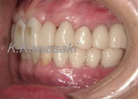 ���×�@�������ȁE�R�����ȁE�C���v�����g�̐�莕�ȁE�������Ȉ�@�i���{�s�j