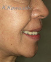 ���×�@�������ȁE�R�����ȁE�C���v�����g�̐�莕�ȁE�������Ȉ�@�i���{�s�j