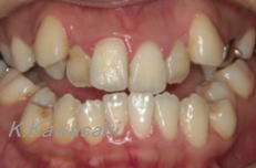 ���×�@�������ȁE�R�����ȁE�C���v�����g�̐�莕�ȁE�������Ȉ�@�i���{�s�j