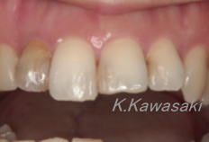 ���×�@�������ȁE�R�����ȁE�C���v�����g�̐�莕�ȁE�������Ȉ�@�i���{�s�j