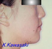 ���Ι����i�󂯌��j�̎��×�@�����E�R�����ȁE�C���v�����g�̐�莕�ȁE�������Ȉ�@�i���{�s�j