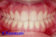 �J���̎��×�@�����E�R�����ȁE�C���v�����g�̐�莕�ȁE�������Ȉ�@�i���{�s�j