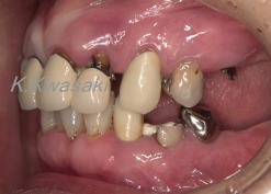 ���×�@�������ȁE�R�����ȁE�C���v�����g�̐�莕�ȁE�������Ȉ�@�i���{�s�j