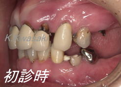 ���×�@�������ȁE�R�����ȁE�C���v�����g�̐�莕�ȁE�������Ȉ�@�i���{�s�j