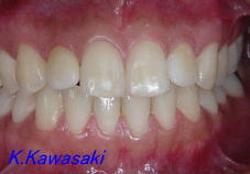 ���×�@�������ȁE�R�����ȁE�C���v�����g�̐�莕�ȁE�������Ȉ�@�i���{�s�j