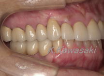 ���×�@�������ȁE�R�����ȁE�C���v�����g�̐�莕�ȁE�������Ȉ�@�i���{�s�j