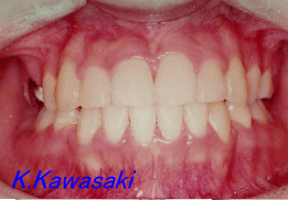 ���Ι����i�󂯌��j�̎��×�@�����E�R�����ȁE�C���v�����g�̐�莕�ȁE�������Ȉ�@�i���{�s�j