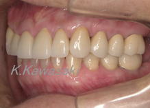 ���×�@�������ȁE�R�����ȁE�C���v�����g�̐�莕�ȁE�������Ȉ�@�i���{�s�j