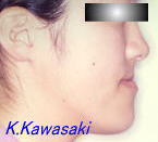 ���i���󂯌��̎��×�@�����E�R�����ȁE�C���v�����g�̐�莕�ȁE�������Ȉ�@�i���{�s�j