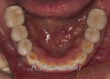 ���×�@�������ȁE�R�����ȁE�C���v�����g�̐�莕�ȁE�������Ȉ�@�i���{�s�j