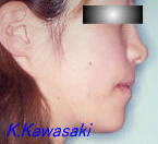 ���i���󂯌��̎��×�@�����E�R�����ȁE�C���v�����g�̐�莕�ȁE�������Ȉ�@�i���{�s�j