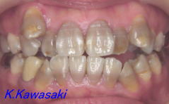 ���×�@�������ȁE�R�����ȁE�C���v�����g�̐�莕�ȁE�������Ȉ�@�i���{�s�j