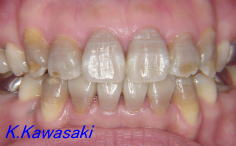 ���×�@�������ȁE�R�����ȁE�C���v�����g�̐�莕�ȁE�������Ȉ�@�i���{�s�j