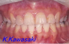 �p���i�K�^�K�^�j�̎��×�@�����E�R�����ȁE�C���v�����g�̐�莕�ȁE�������Ȉ�@�i���{�s�j