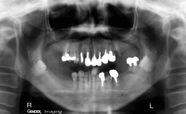 ���×�@�������ȁE�R�����ȁE�C���v�����g�̐�莕�ȁE�������Ȉ�@�i���{�s�j