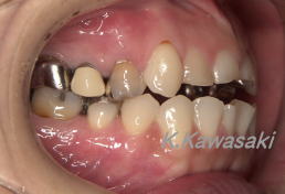 ���×�@�������ȁE�R�����ȁE�C���v�����g�̐�莕�ȁE�������Ȉ�@�i���{�s�j