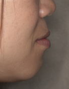 ���×�@�������ȁE�R�����ȁE�C���v�����g�̐�莕�ȁE�������Ȉ�@�i���{�s�j