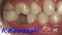 矯正歯科、審美歯科、インプラントの川崎歯科・矯正歯科医院（松本市） 