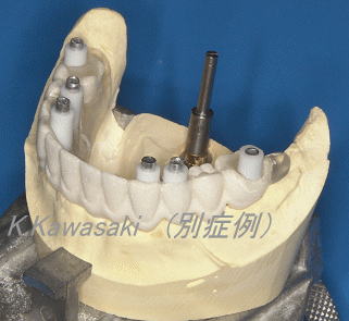 ���×�@�������ȁE�R�����ȁE�C���v�����g�̐�莕�ȁE�������Ȉ�@�i���{�s�j